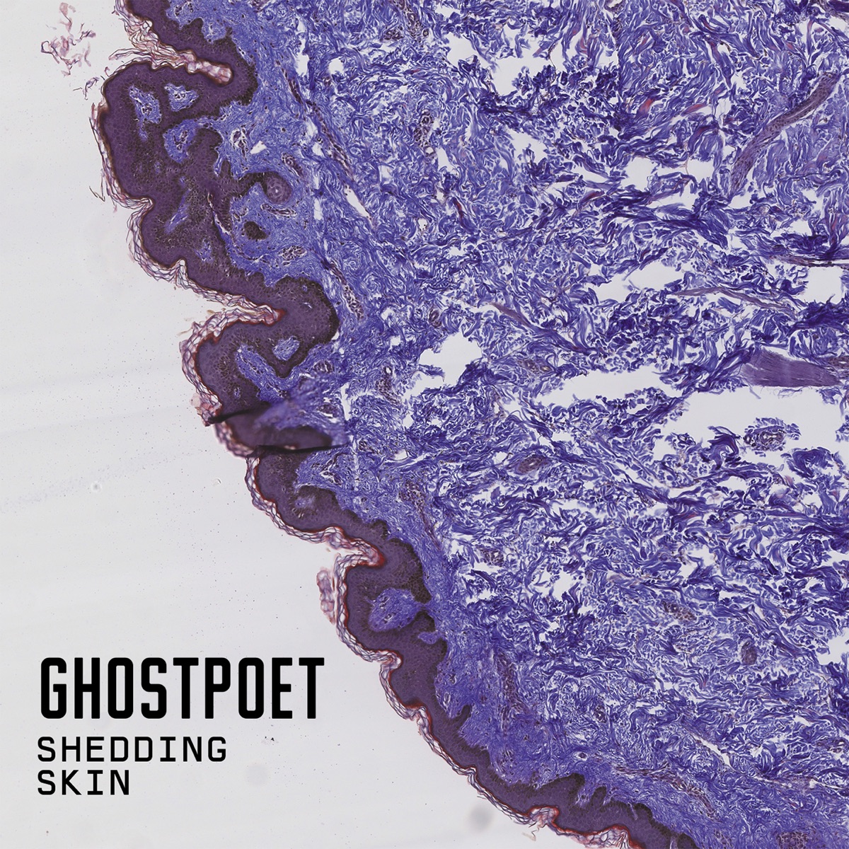 Shedding Skin by Ghostpoet